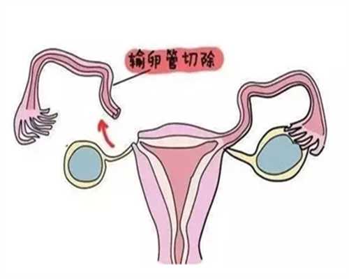 <b>青岛试管代孕流程步骤,青岛妇幼试管婴儿检查项目有哪些？男女双方有什么不</b>